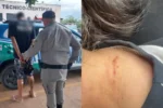 Motorista ficou com marcas no pescoço devido a agressão - (Foto: divulgação/PM)