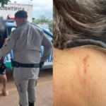 Motorista ficou com marcas no pescoço devido a agressão - (Foto: divulgação/PM)